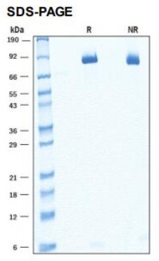 SDS PAGE (SORL1-01H).jpg